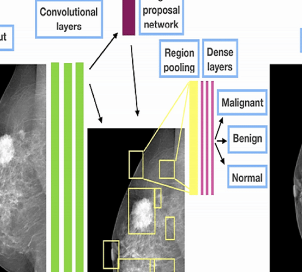 image of product پایپ لاین دسته بندی تصاویر ماموگرافی بر پایه CNN و الگوریتم های فراابتکاری